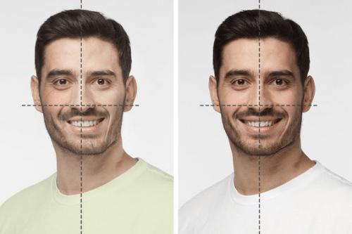 Miért lesz az arc aszimmetriája feltűnőbb idősebb korban?